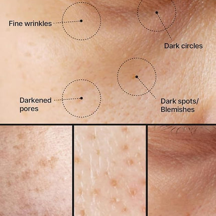 Pore + Dark Spot Face Cream with Niacinamide and TXA, 35ml