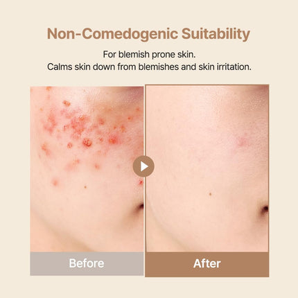 GlowEssence EsenciaLuz PURITO Oat In Calming Gel Cream, Non-Comedogenic, 77% Oat Seed Water — Beauty & Self-Care