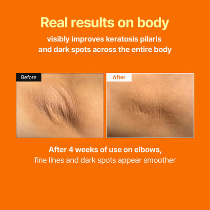 Retinal Skin Booster Serum with Retinaldehyde and Niacinamide, 5.07 fl oz