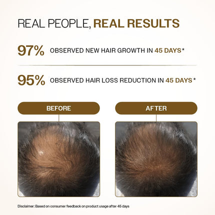 Advanced Hair Density Roll-On, 25ml