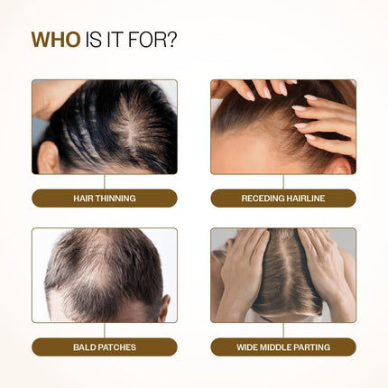 Advanced Hair Density Roll-On, 25ml