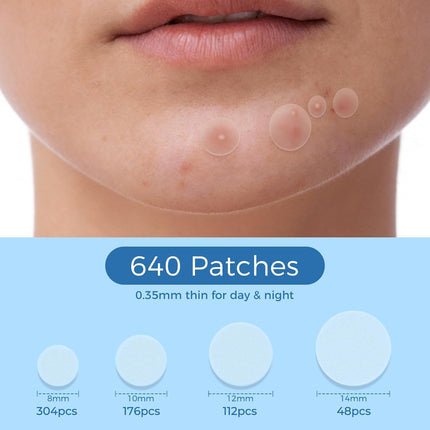 640-Count Hydrocolloid Pimple Patches for Face