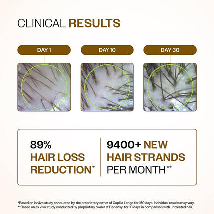 Advanced Hair Density Serum, 30 ml