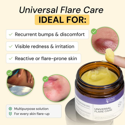 Universal Flare Care Drawing Salve for Everyday Skin Flare-Ups, 4 oz