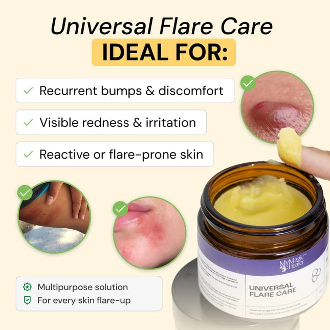 Universal Flare Care Drawing Salve for Everyday Skin Flare-Ups, 4 oz