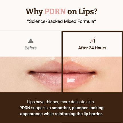 Advanced PDRN Rejuvenating Lip Serum - Hydrating Lip Balm for Glowy, Dewy Lips, 0.3 Fl Oz