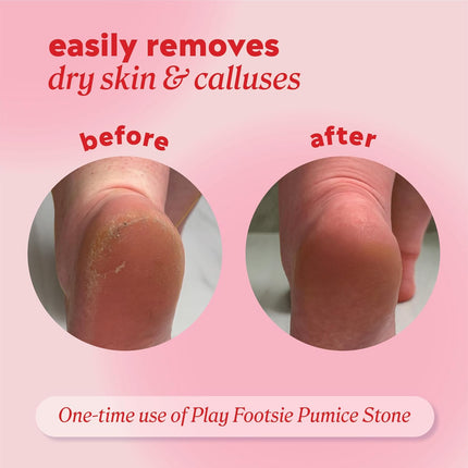 Double Sided Siliglass Pumice Stone Callus Remover, 2 Pack