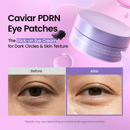 Caviar PDRN Nourishing Under Eye Patches, 60 Count