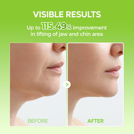 Cactox V-Lifting Mewing Band for Jawline, Chin & Facial Puffiness