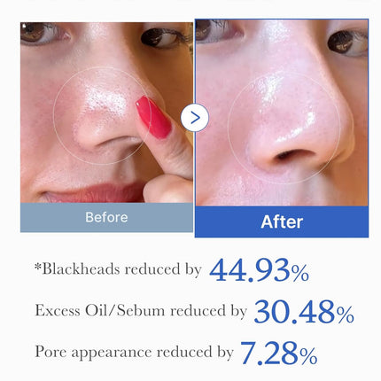 medicube Zero Pore Pad - how to use guide