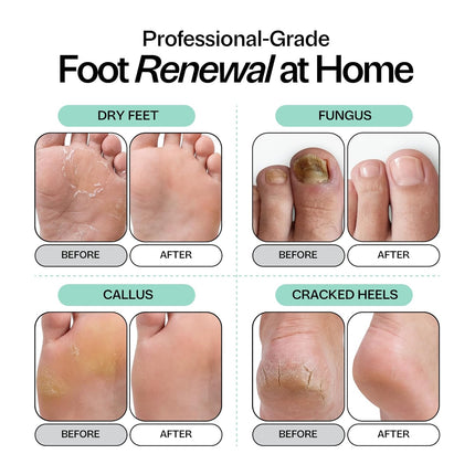 Tea Tree Oil Foot Soak with Epsom Salt, 16 oz