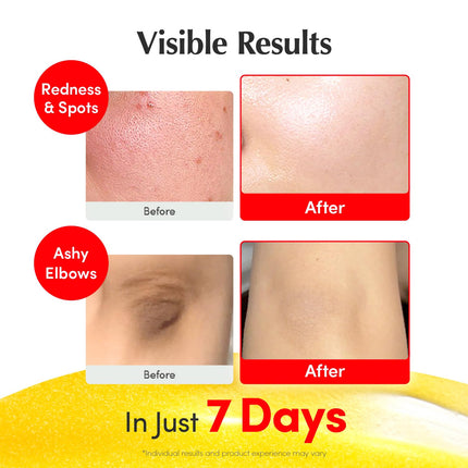 Vitamin Illuminating Face Serum with Niacinamide 4%, TXA & Hyaluronic Acid, 1.01 fl oz