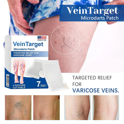 DriveForge ForjaRuta VeinTarget Microdarts Patch, Professional Varicose Veins Treatment for Legs — Auto & Moto