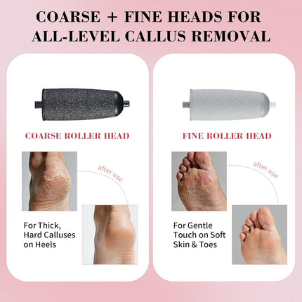 SourceToHome FuenteACasa Electric Foot Callus Remover, Rechargeable Foot File Pedicure Kit — Home & Lifestyle