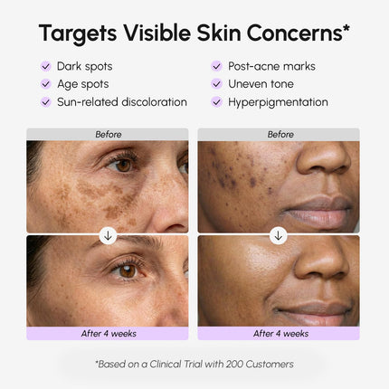 Dark Spot Corrector Serum for Face and Body