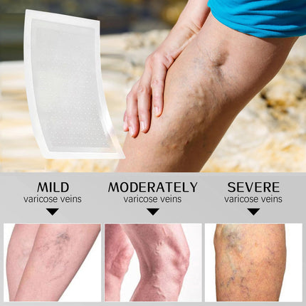DriveForge ForjaRuta VeinTarget Microdarts Patch, Professional Varicose Veins Treatment for Legs — Auto & Moto