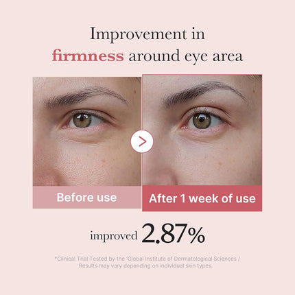 Eye Serum with Salmon DNA PDRN, Pink Peptides & Retinol, 1.01 fl oz