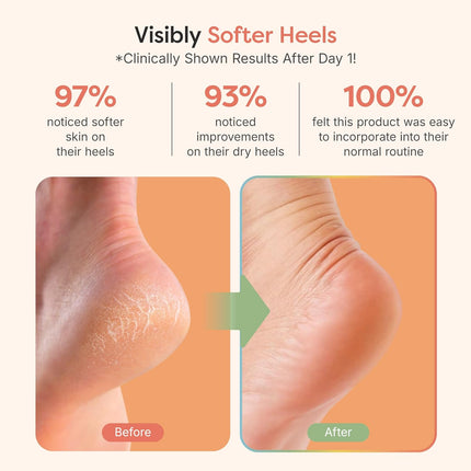 Moisturizing Heel Socks for Cracked Heel Treatment, Fuzzy Pink Regular