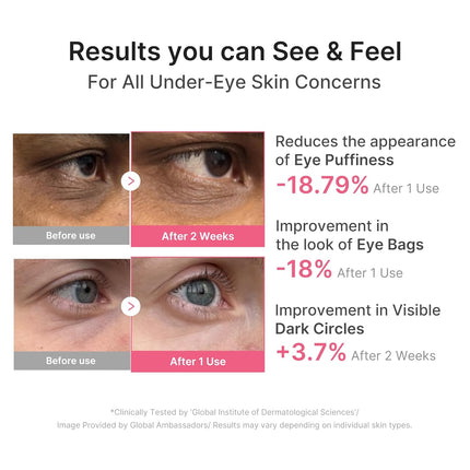 PDRN Caffeine Collagen Gel Eye Patches, 30 Pairs
