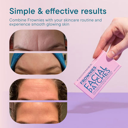 Forehead and Between-the-Eyes Wrinkle Patches, 144 Count