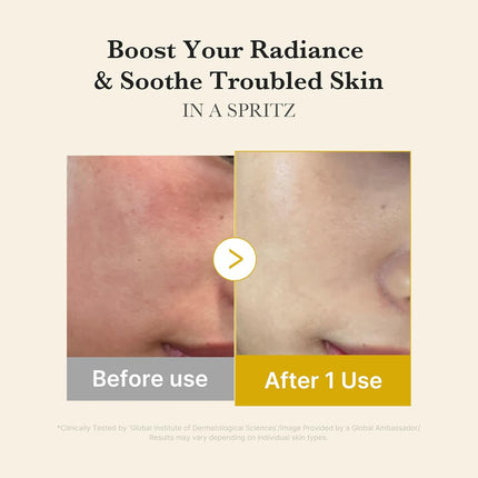 Jelly Mist Serum with Kojic Acid and Turmeric
