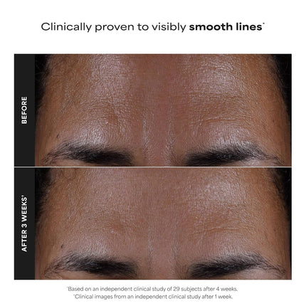 Skin Perfecting 2% BHA Liquid Salicylic Acid Facial Exfoliant, 4 oz